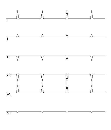 EKG zur Abfrage