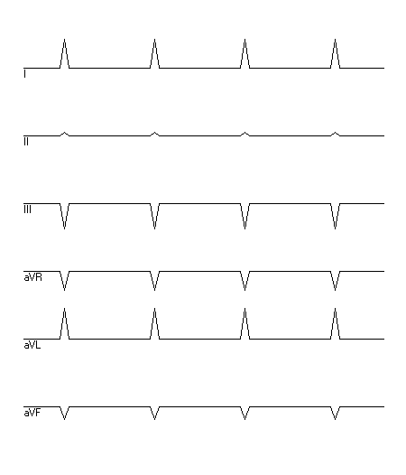 EKG zur Abfrage