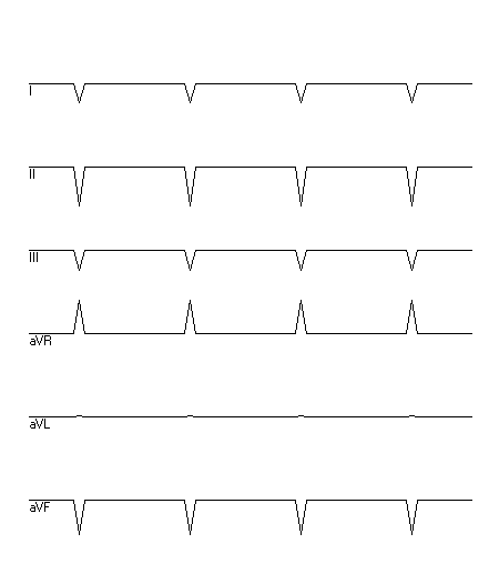 EKG zur Abfrage