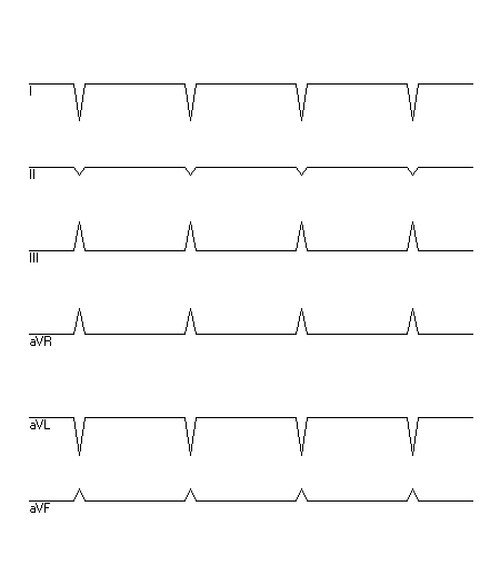 EKG zur Abfrage