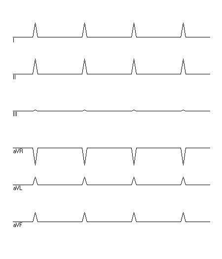 EKG zur Abfrage