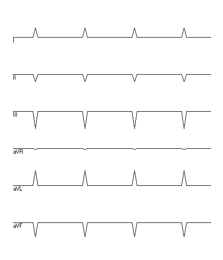 EKG zur Abfrage