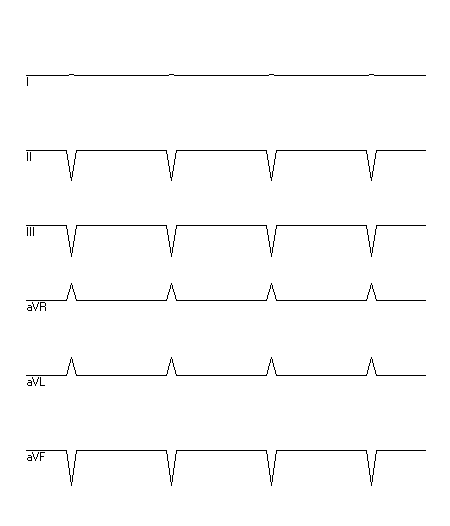 EKG zur Abfrage