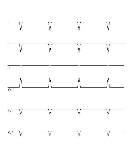 EKG zur Abfrage