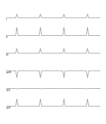 EKG zur Abfrage