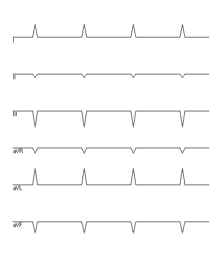 EKG zur Abfrage