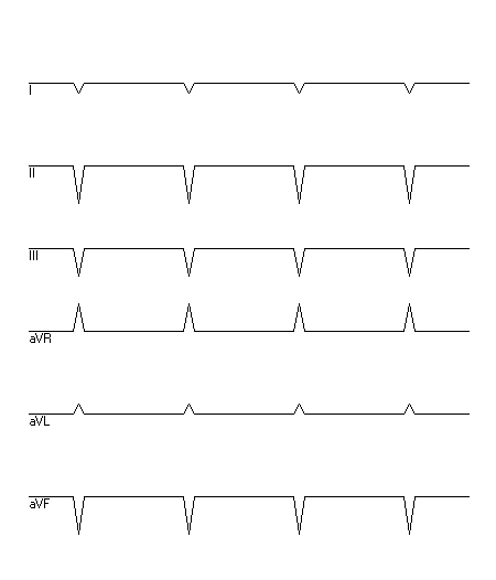 EKG zur Abfrage