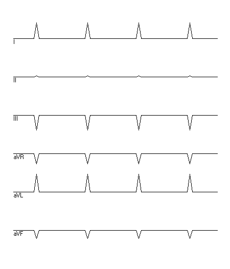 EKG zur Abfrage