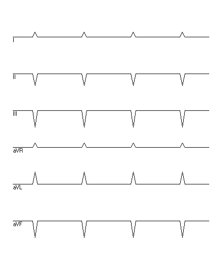 EKG zur Abfrage