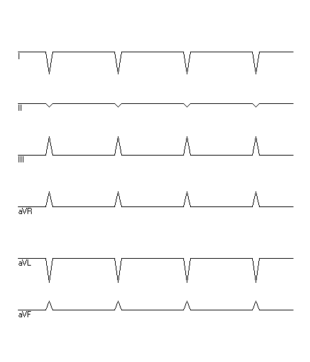 EKG zur Abfrage