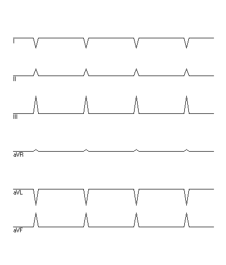 EKG zur Abfrage