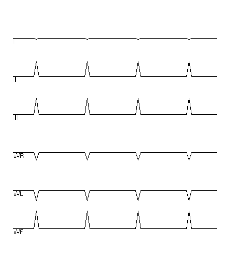 EKG zur Abfrage