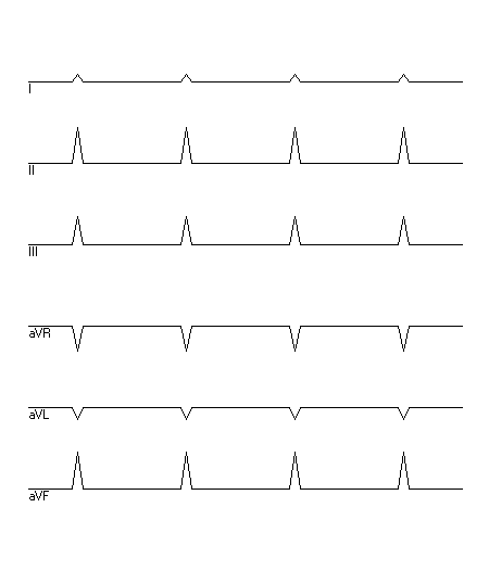 EKG zur Abfrage