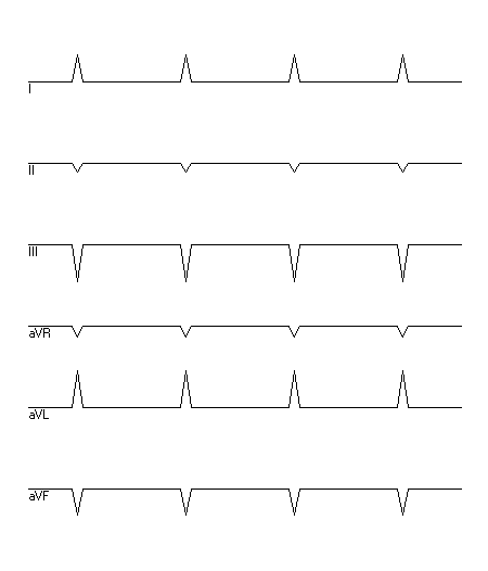 EKG zur Abfrage