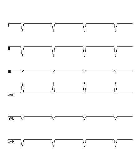 EKG zur Abfrage