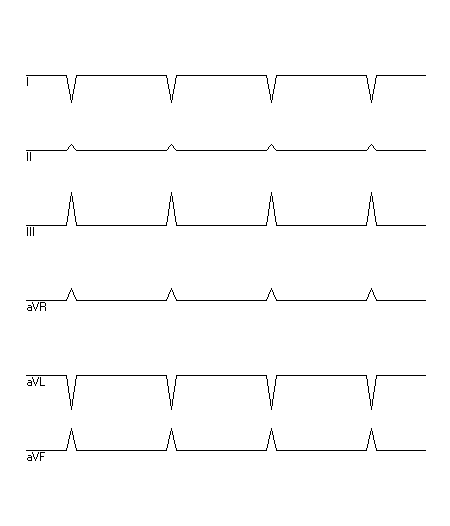 EKG zur Abfrage