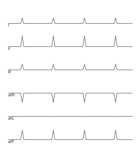 EKG zur Abfrage