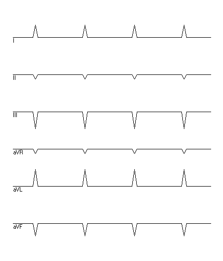 EKG zur Abfrage