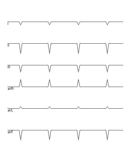 EKG zur Abfrage