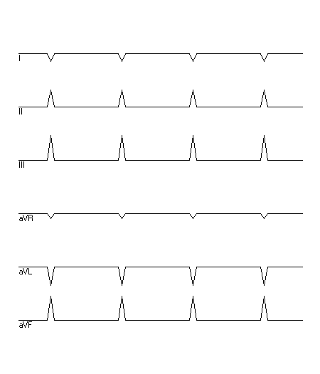 EKG zur Abfrage