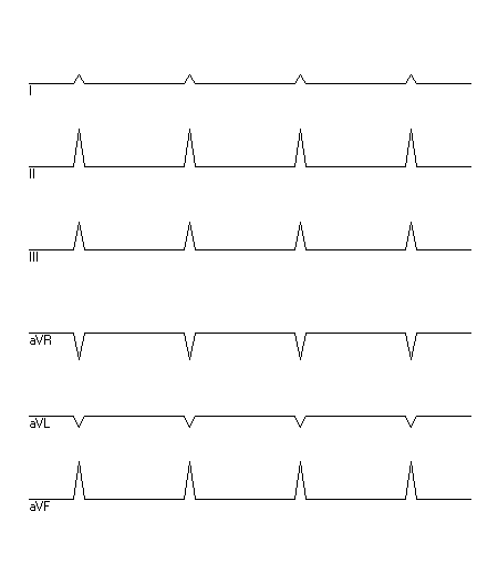 EKG zur Abfrage