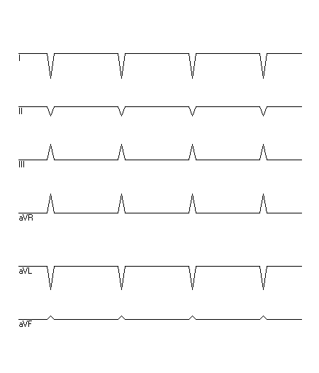 EKG zur Abfrage