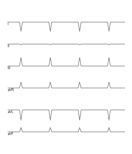 EKG zur Abfrage