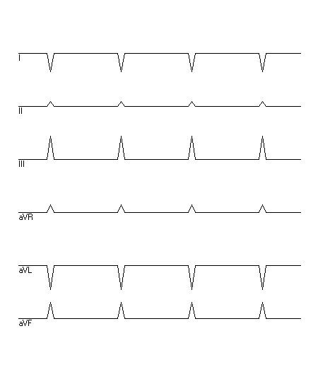 EKG zur Abfrage