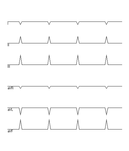 EKG zur Abfrage