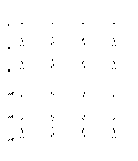 EKG zur Abfrage