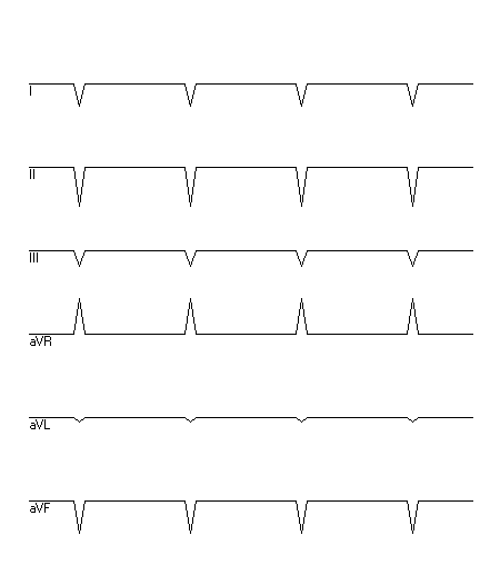 EKG zur Abfrage