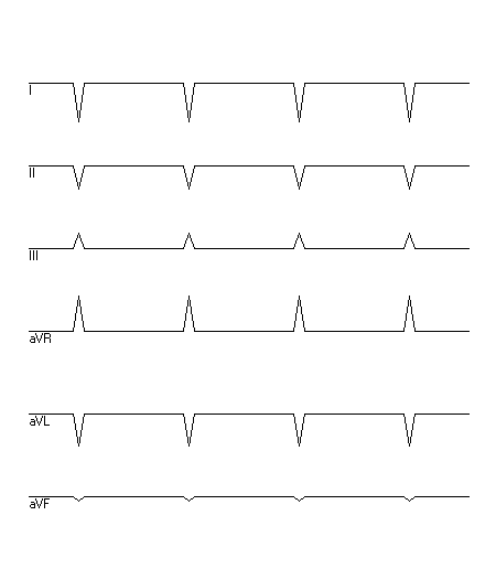 EKG zur Abfrage