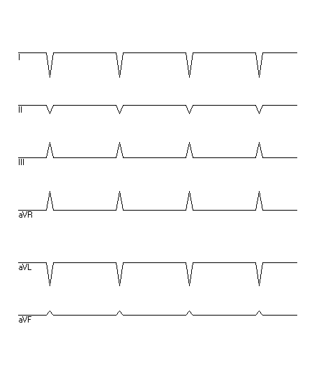 EKG zur Abfrage