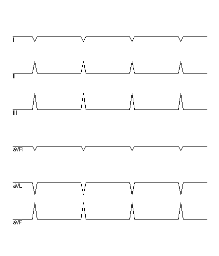 EKG zur Abfrage