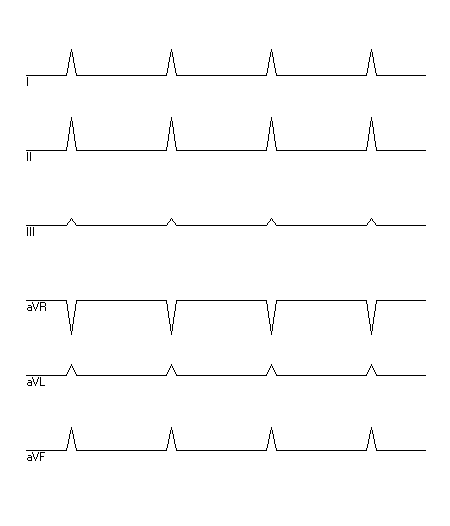 EKG zur Abfrage