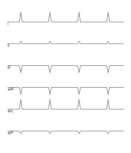 EKG zur Abfrage