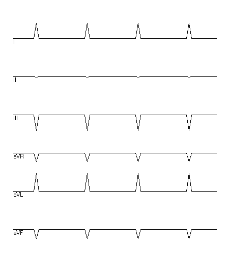 EKG zur Abfrage