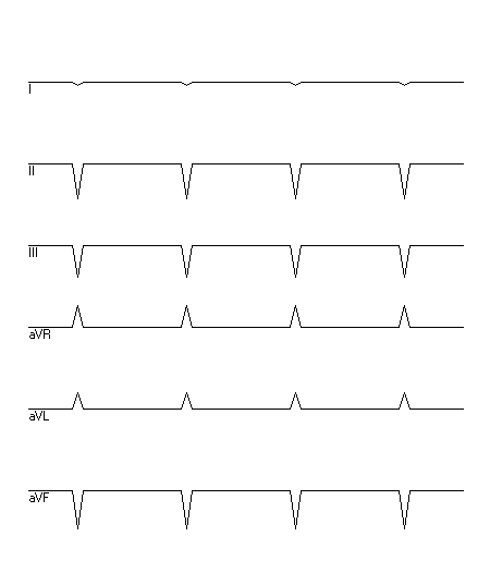 EKG zur Abfrage