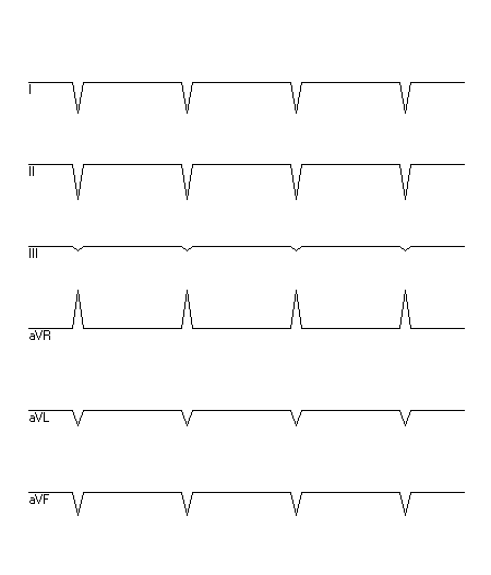 EKG zur Abfrage