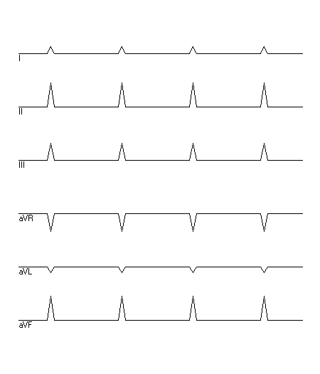 EKG zur Abfrage