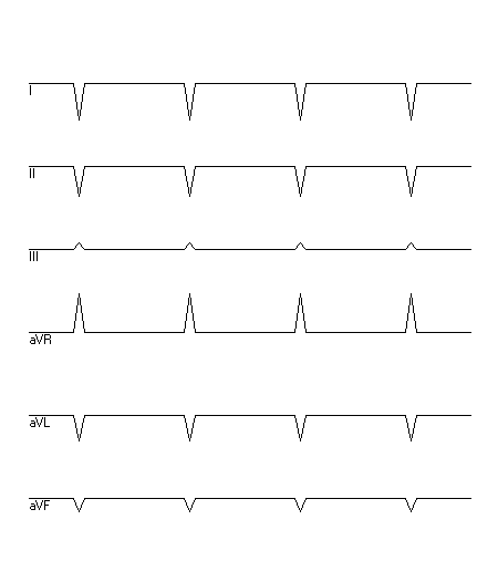 EKG zur Abfrage