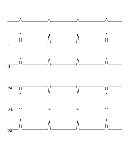 EKG zur Abfrage