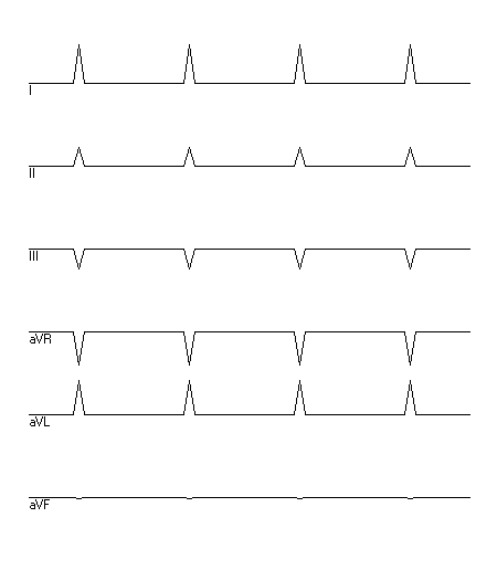 EKG zur Abfrage