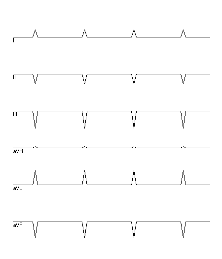 EKG zur Abfrage