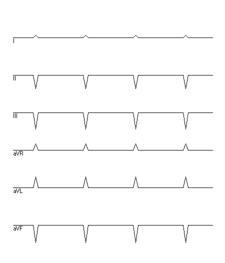 EKG zur Abfrage