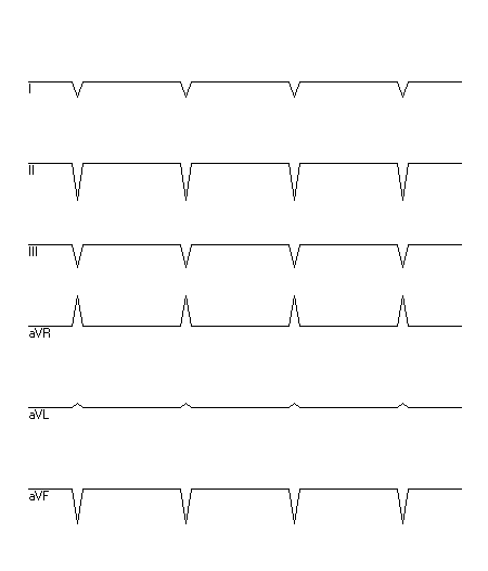 EKG zur Abfrage