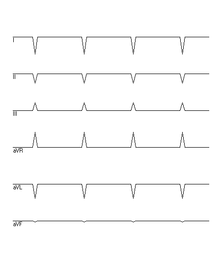 EKG zur Abfrage