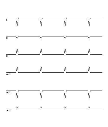 EKG zur Abfrage