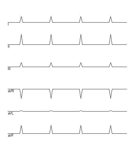 EKG zur Abfrage