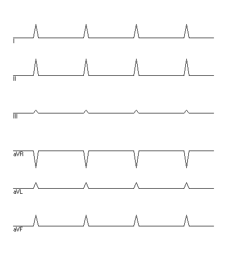 EKG zur Abfrage